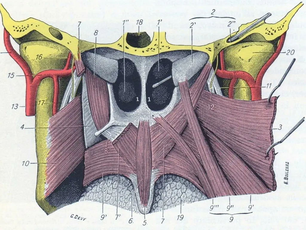 slide5