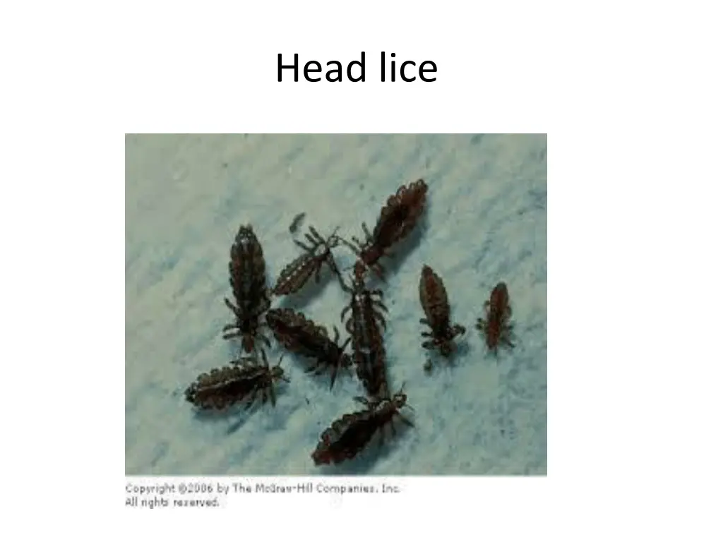 head lice