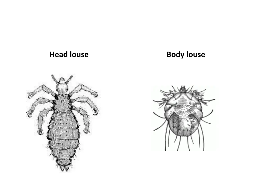 head louse
