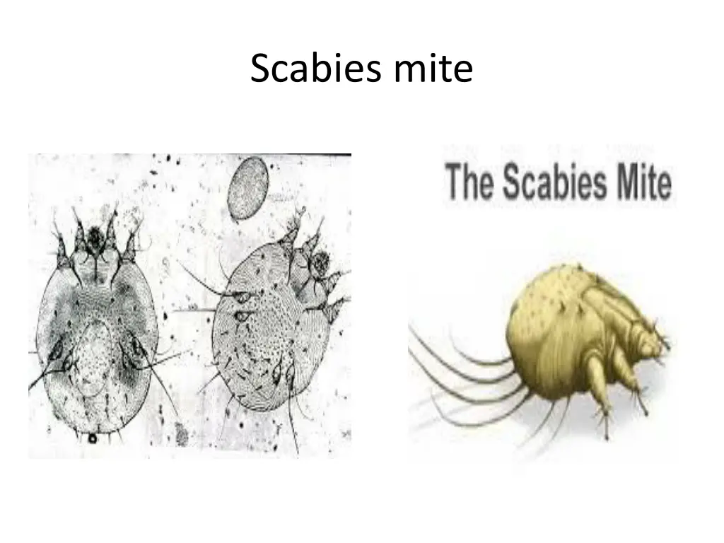 scabies mite