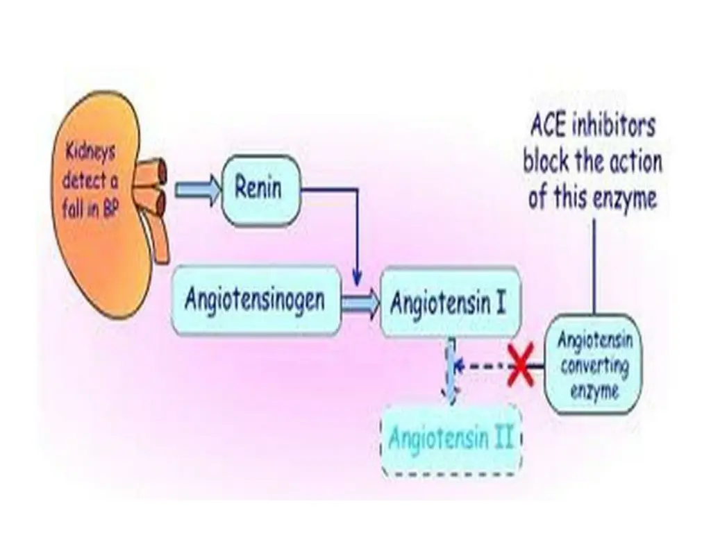 slide4