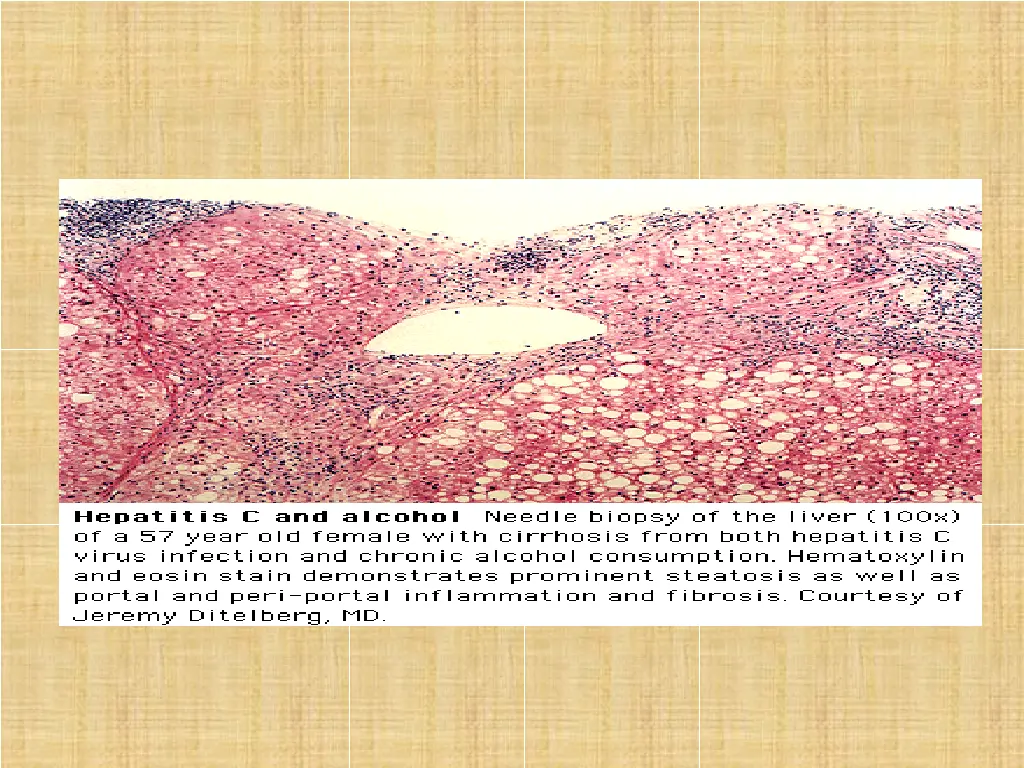slide14