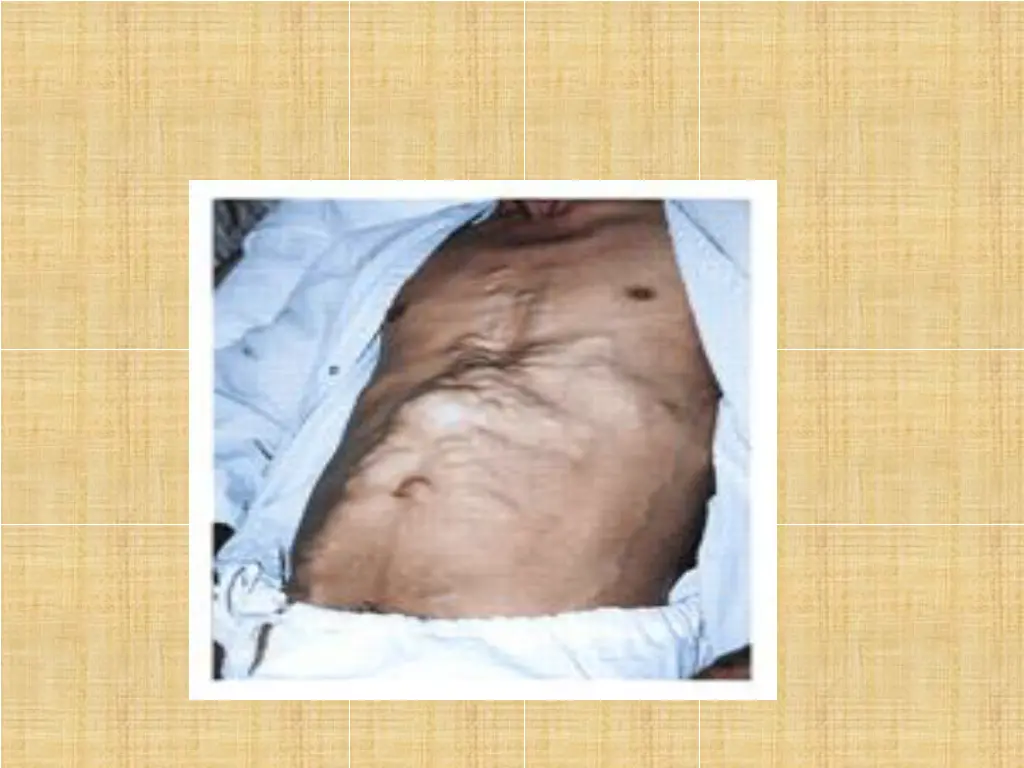 slide9