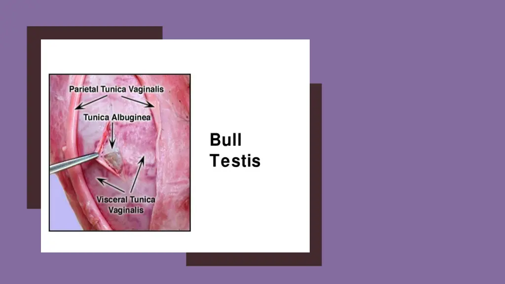 slide5