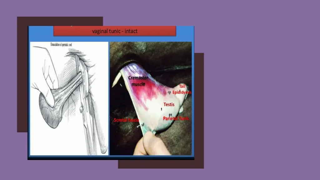 slide7