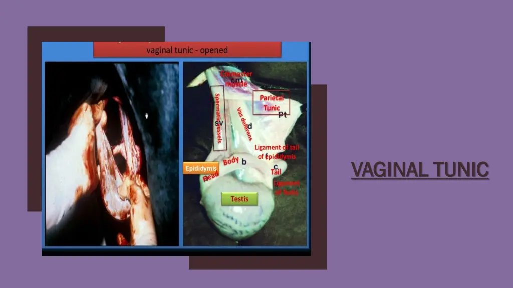 vaginal tunic vaginal tunic