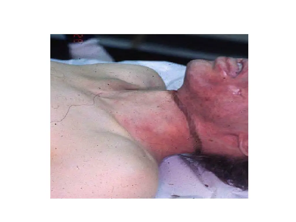 slide18