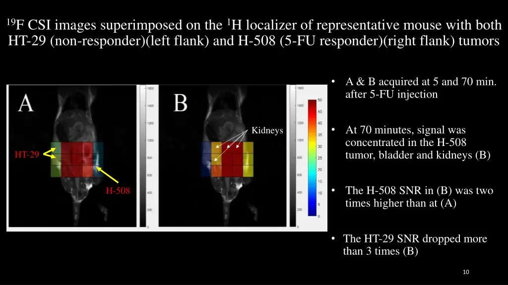 19 f csi images superimposed on the 1 h localizer 1
