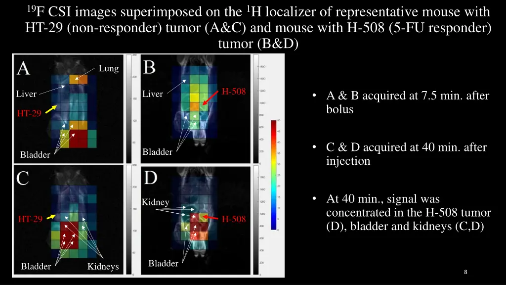 19 f csi images superimposed on the 1 h localizer
