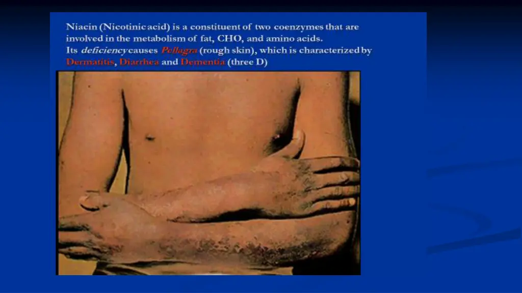 slide6