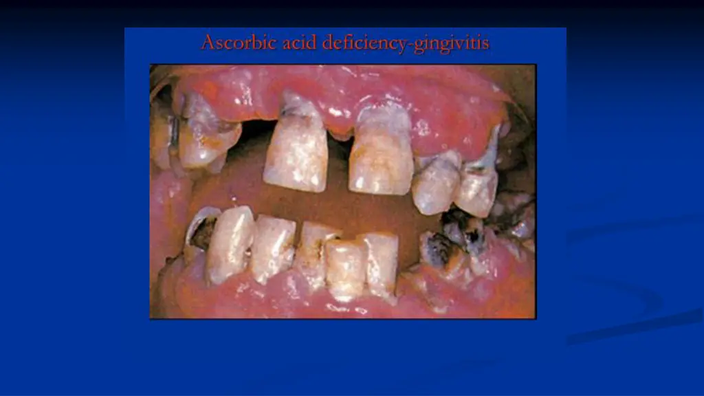 slide7