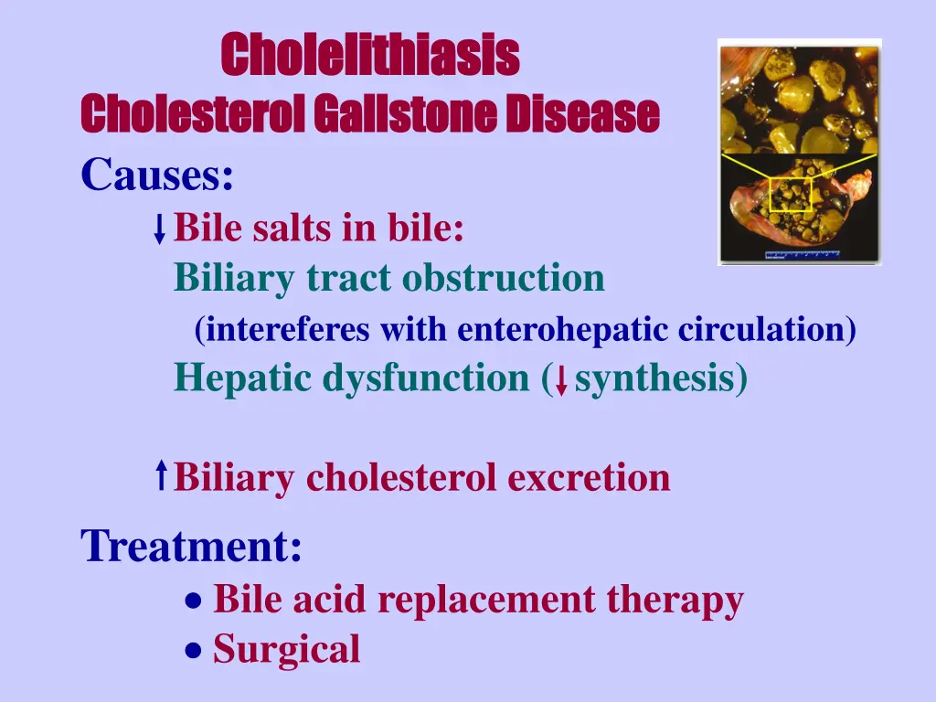 cholelithiasis cholelithiasis cholesterol