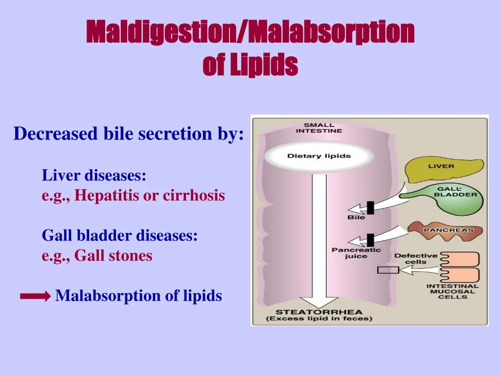 maldigestion maldigestion malabsorption