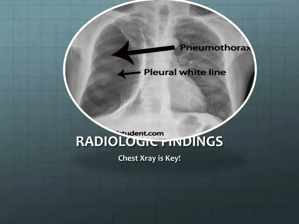 radiologic findings