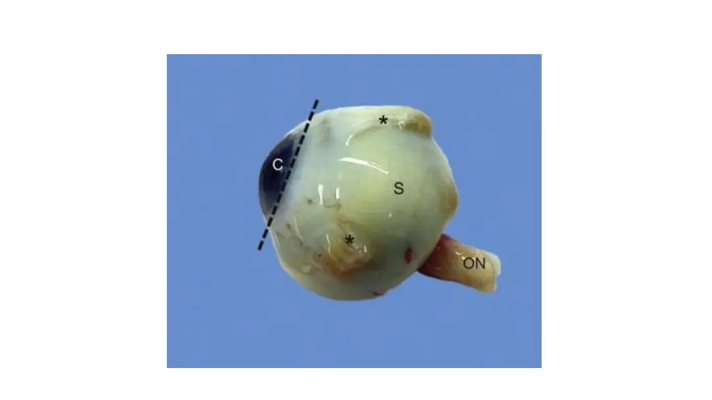 slide3