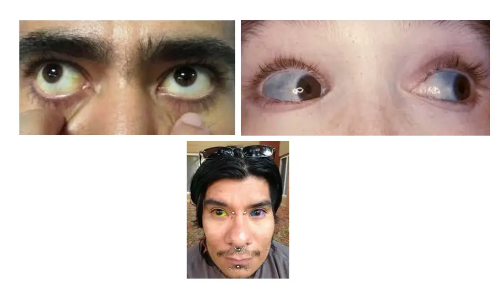 slide5