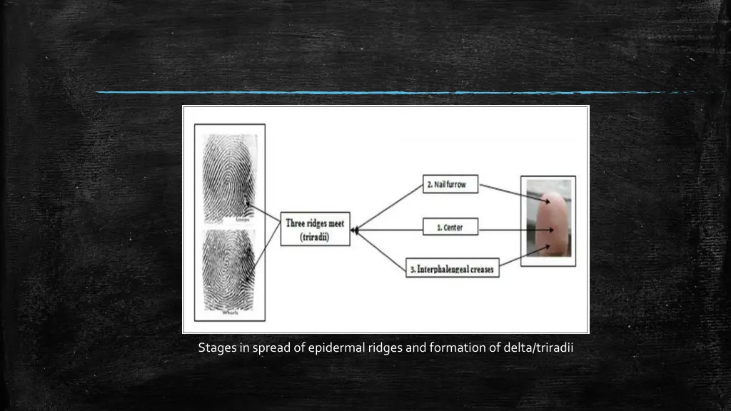 stages in spread of epidermal ridges