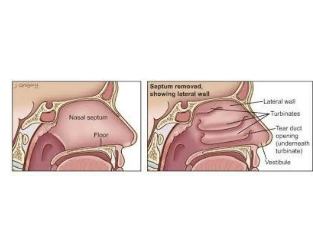 slide19
