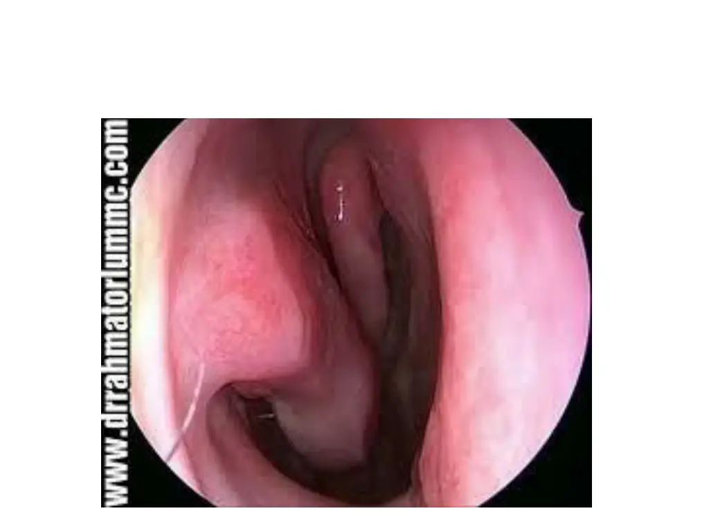 slide20