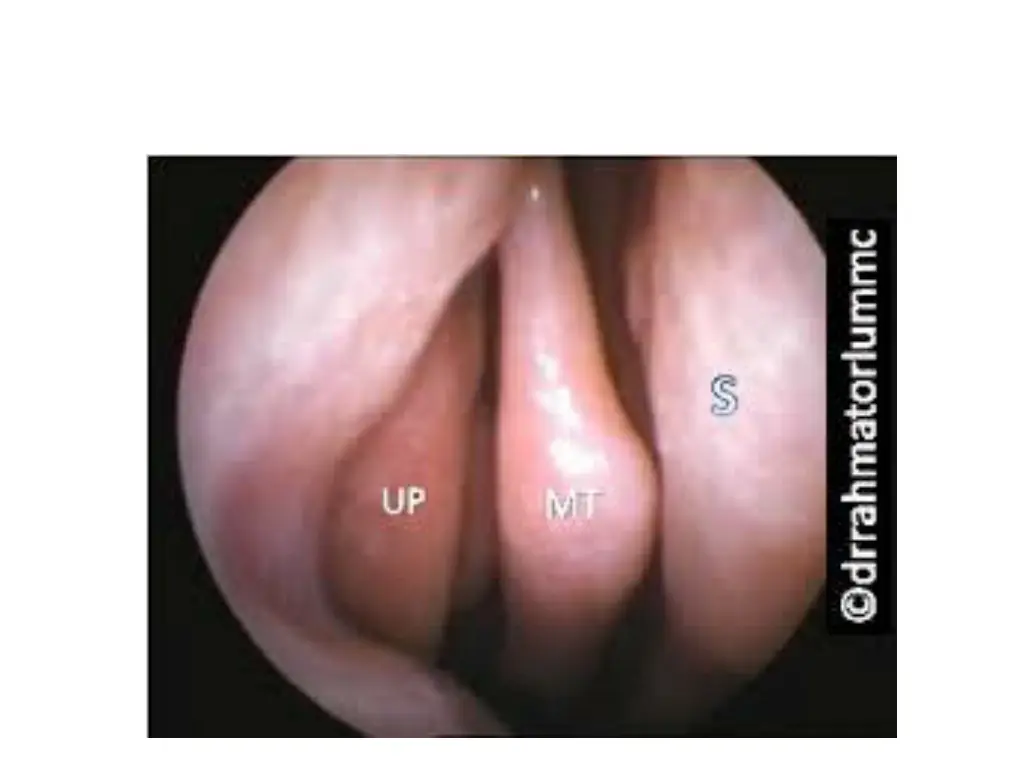 slide21