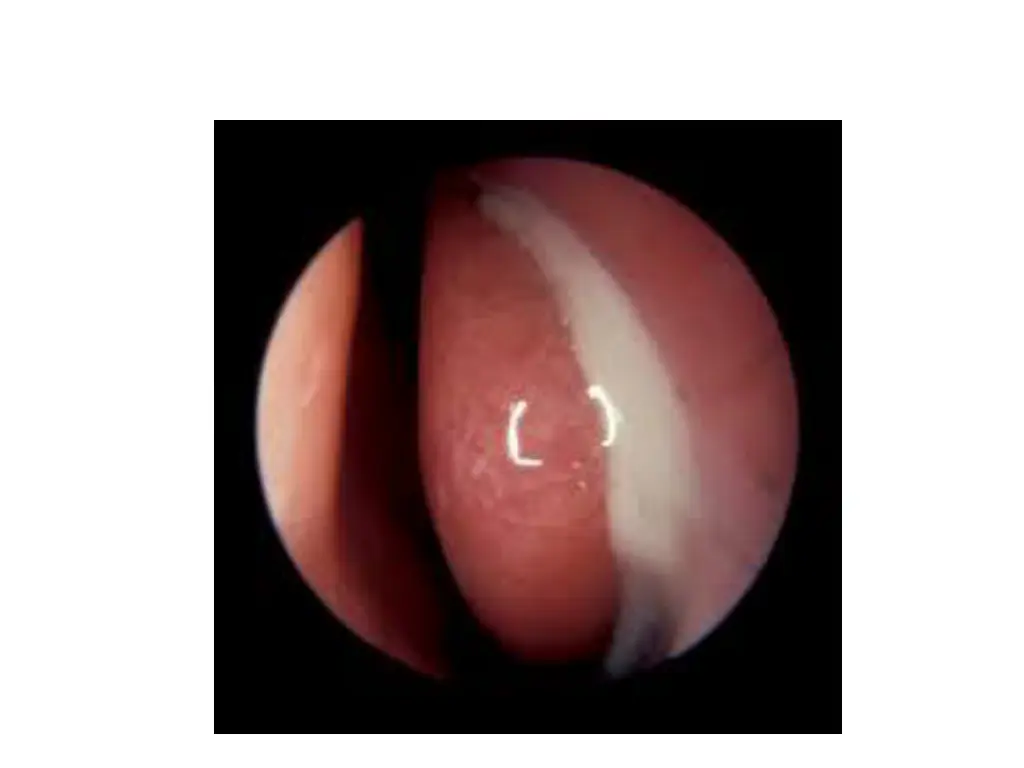 slide22