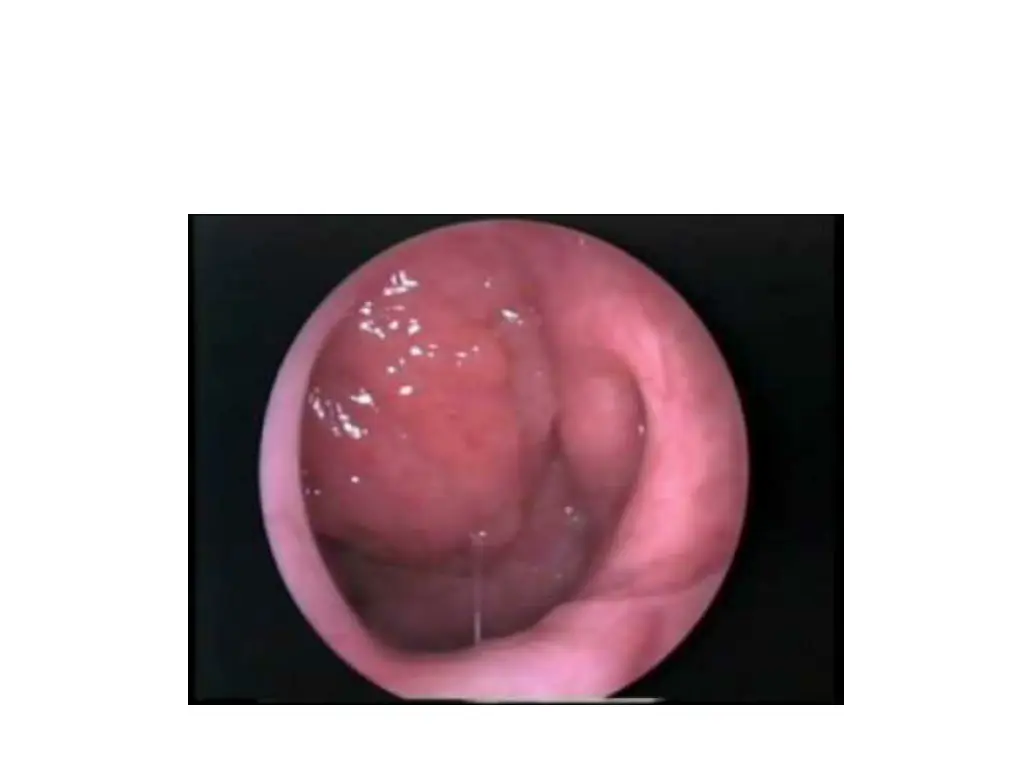 slide24