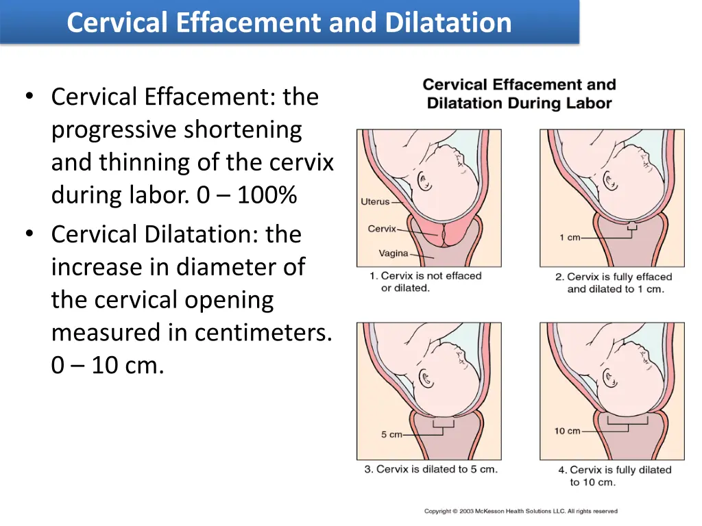 cervical effacement and dilatation