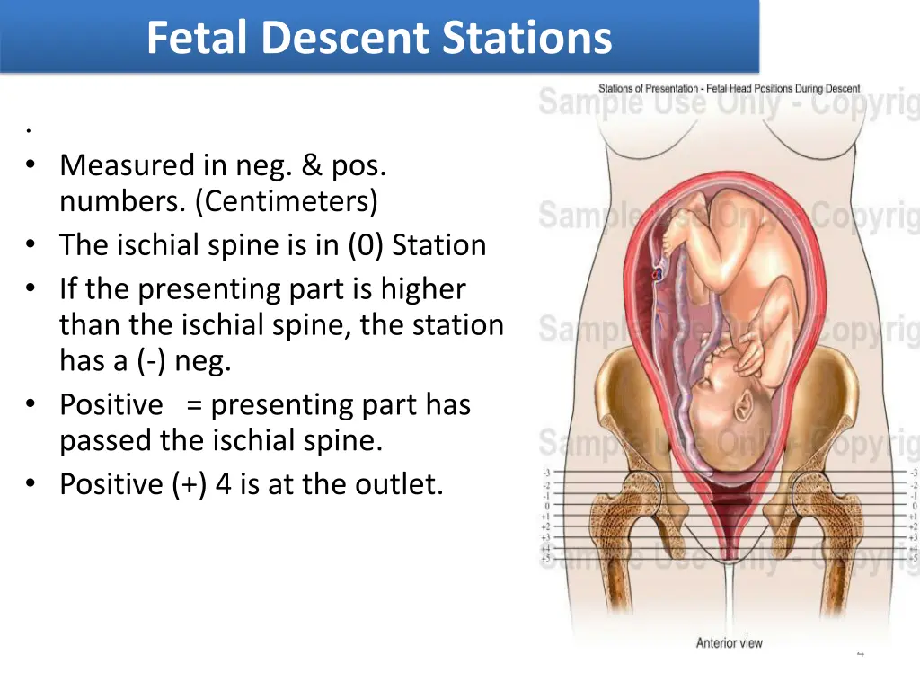 fetal descent stations