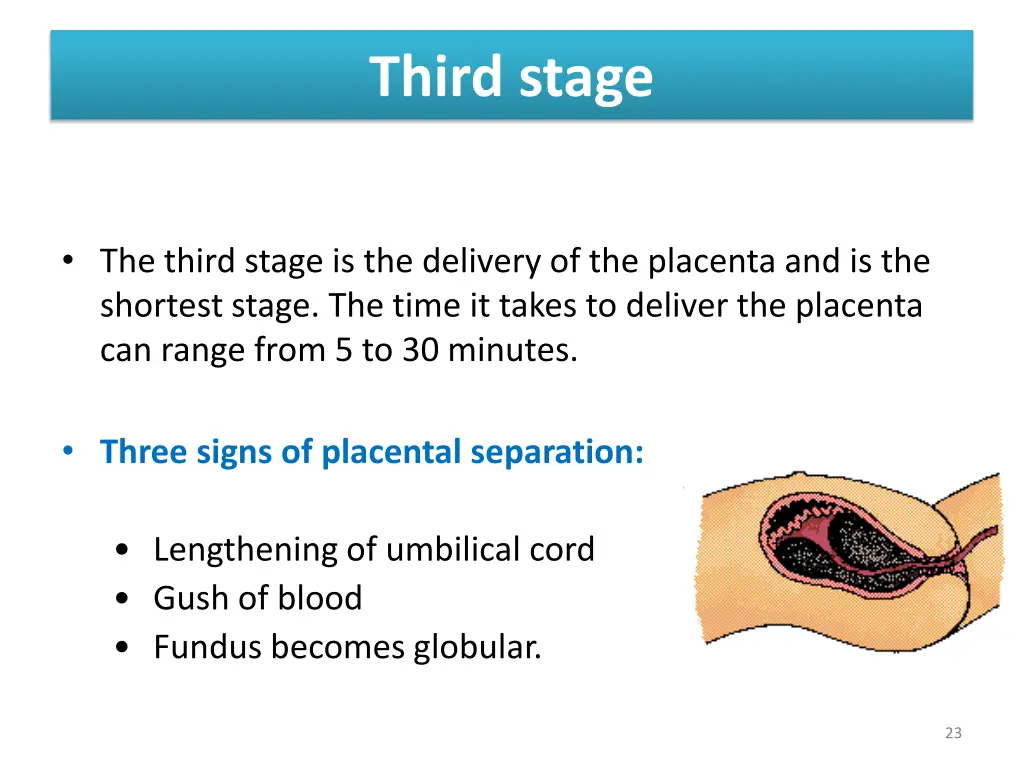 third stage