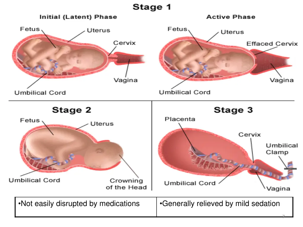 true and false labor contractions 1