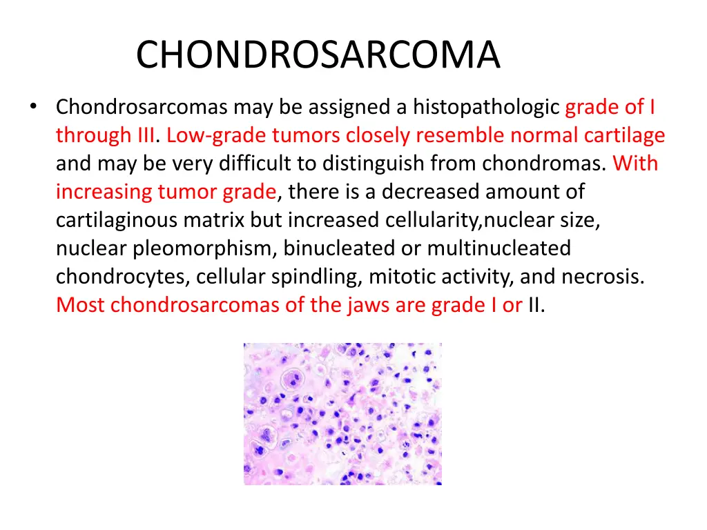 chondrosarcoma 4