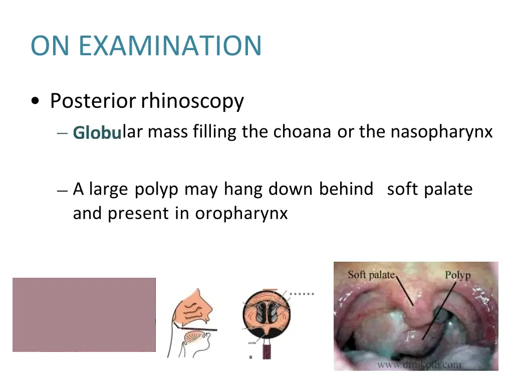 on examination 1