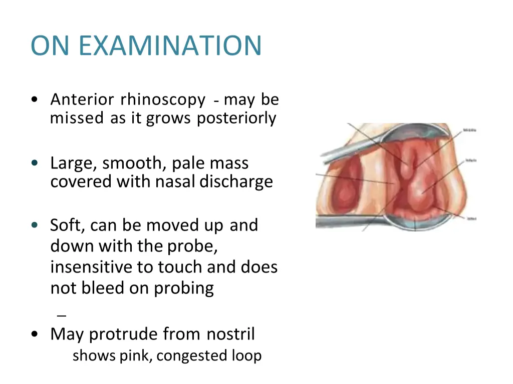 on examination
