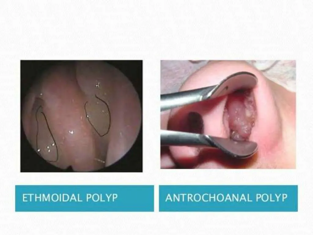 slide24