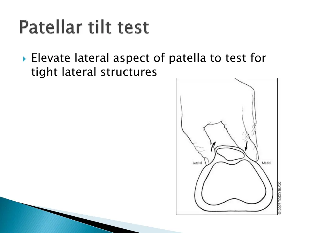 elevate lateral aspect of patella to test