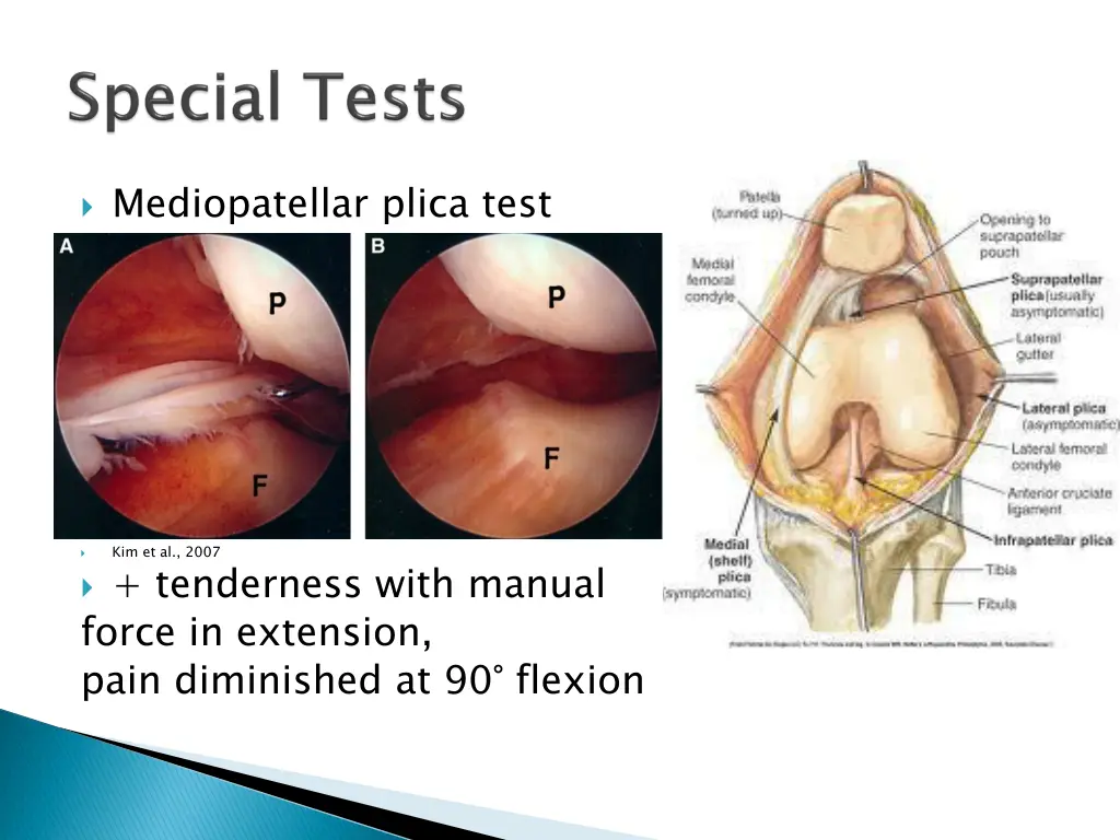 mediopatellar plica test
