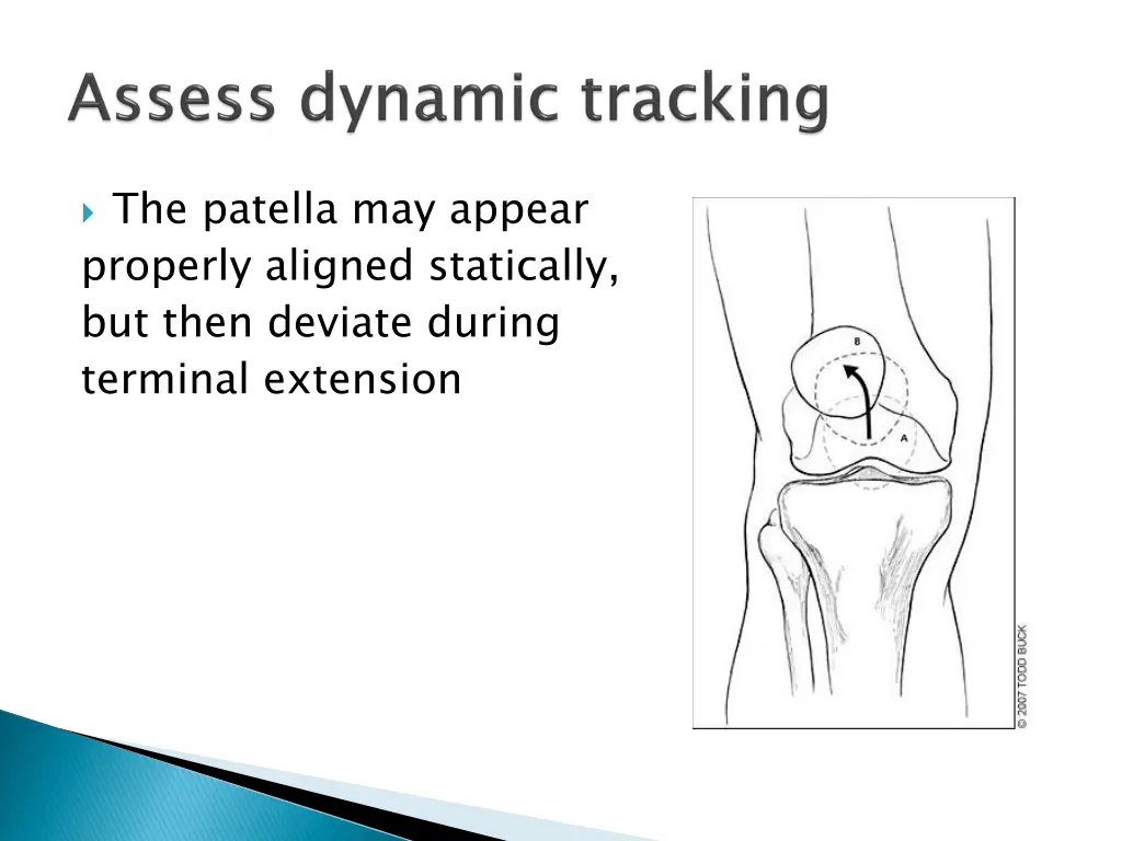 the patella may appear properly aligned
