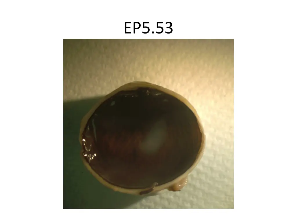 ep5 53
