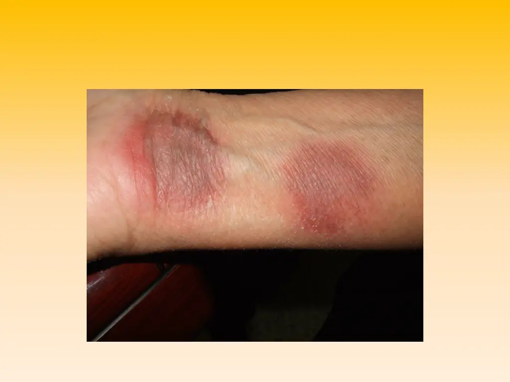 slide10