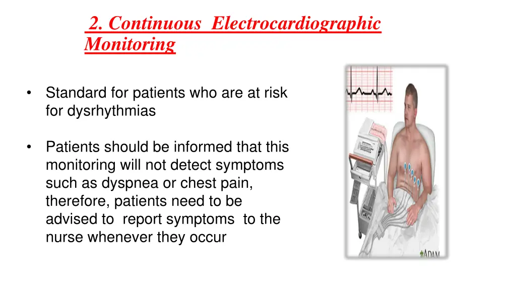 2 continuous electrocardiographic monitoring