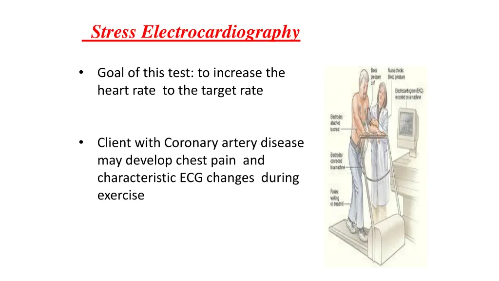 stress electrocardiography