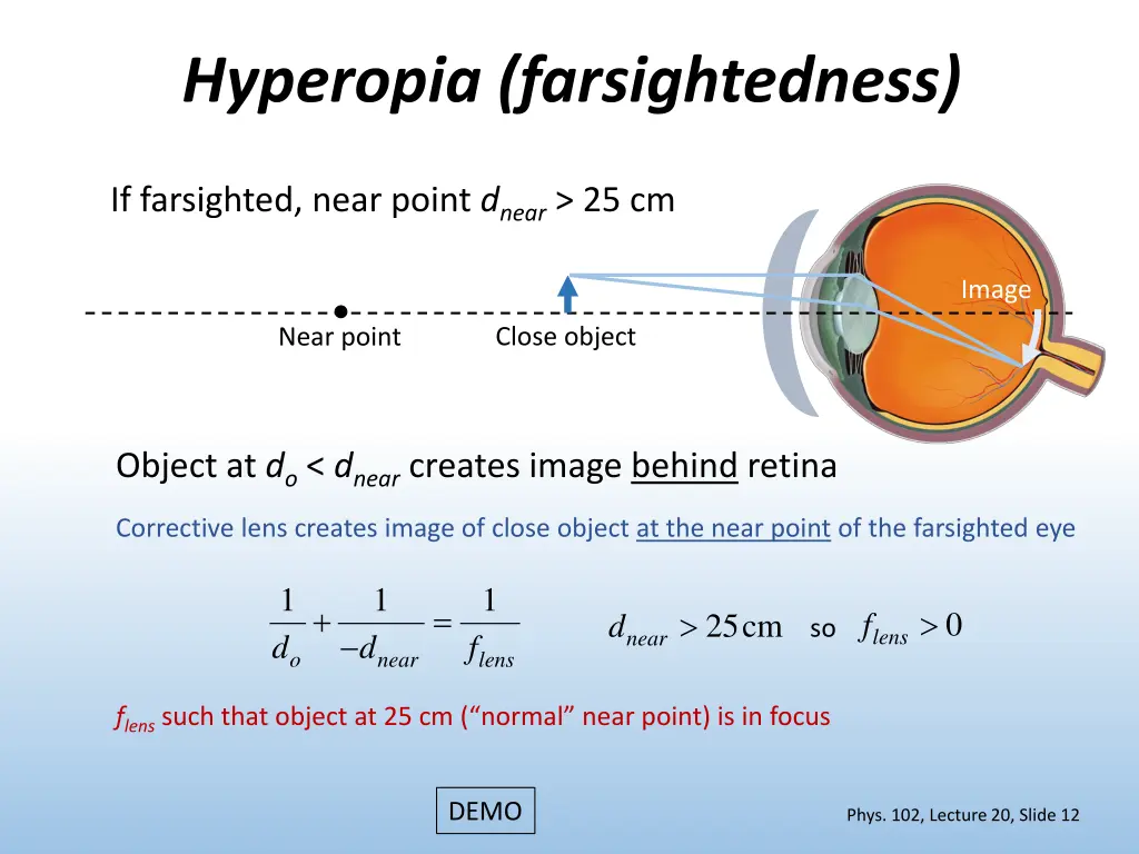 hyperopia farsightedness