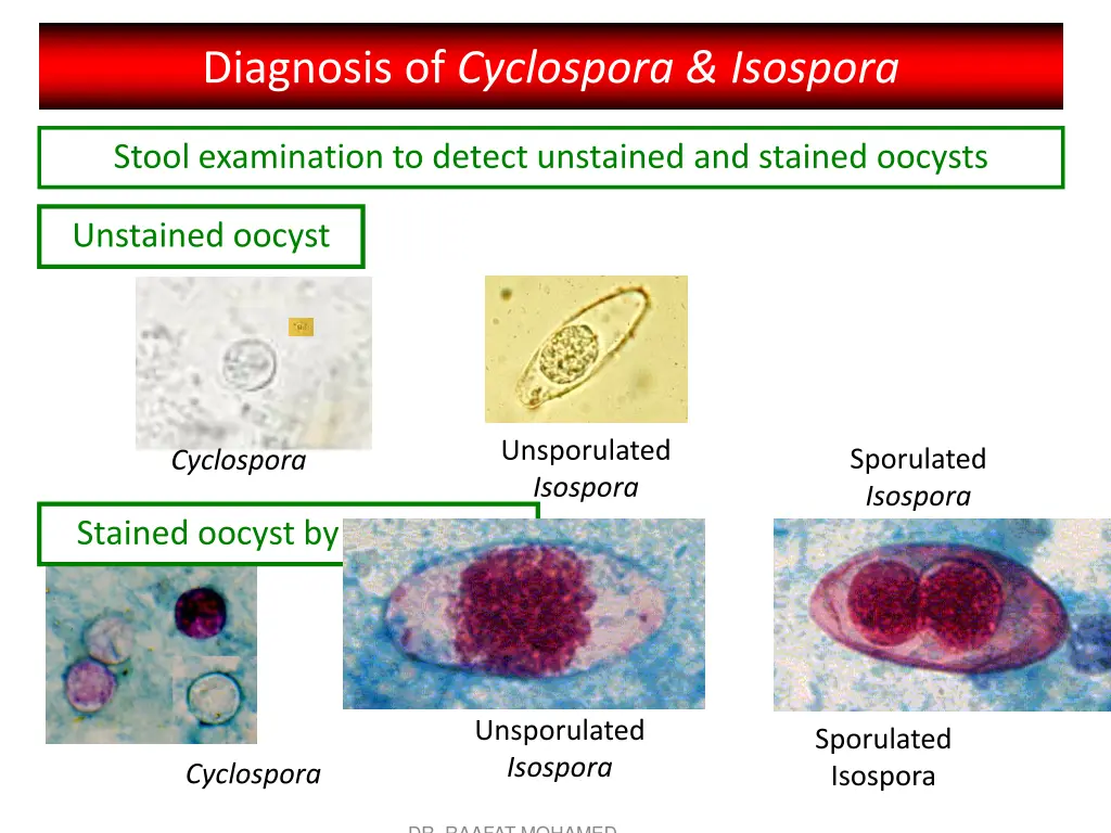 diagnosis of cyclospora isospora