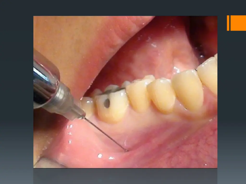 slide40