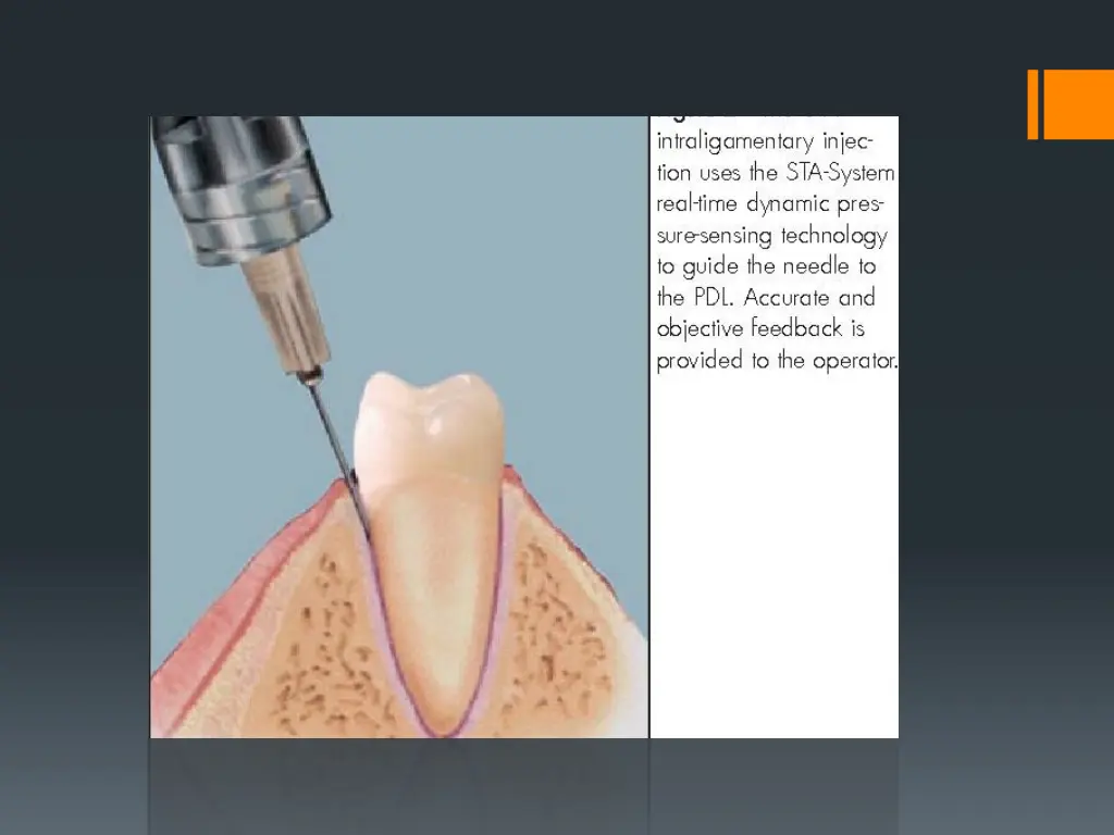 slide42