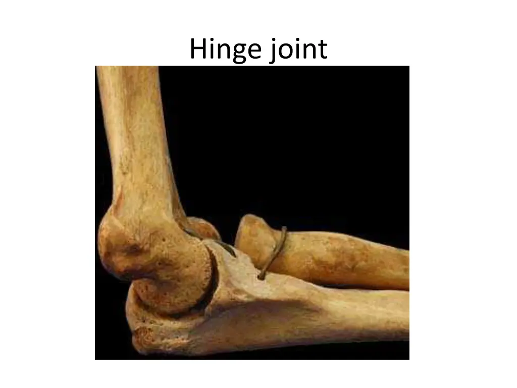 hinge joint