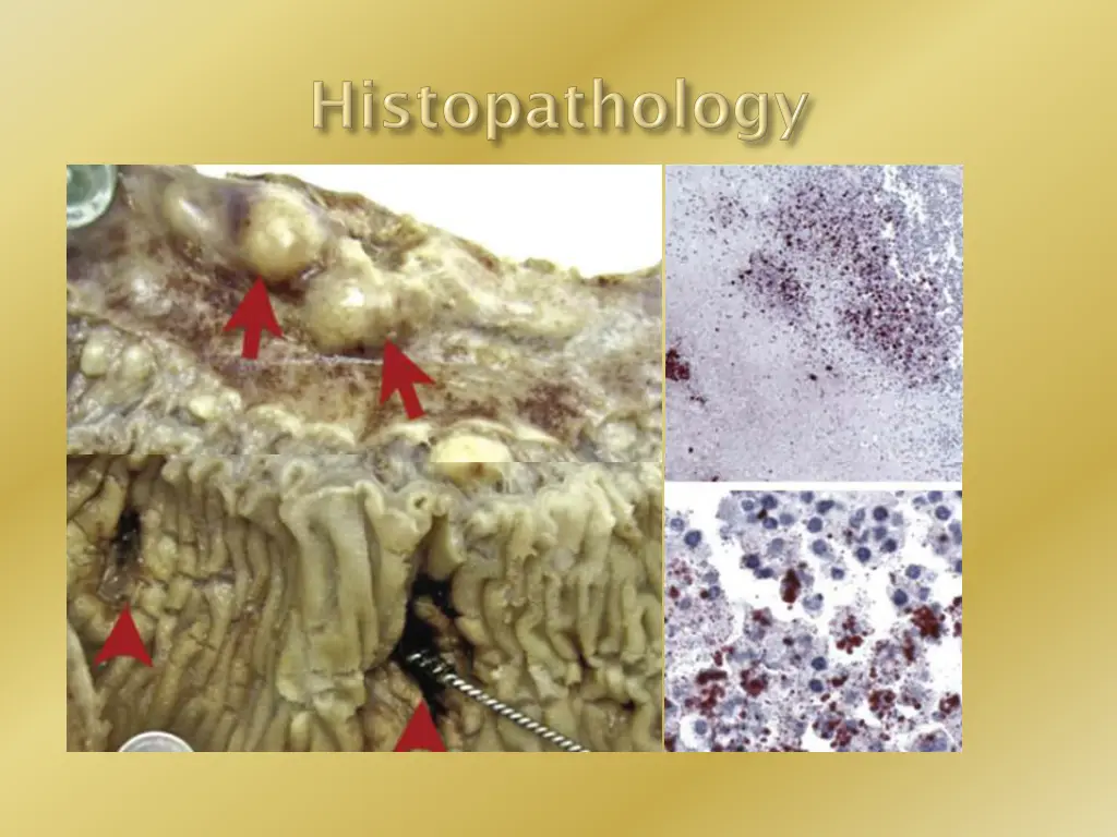 slide6