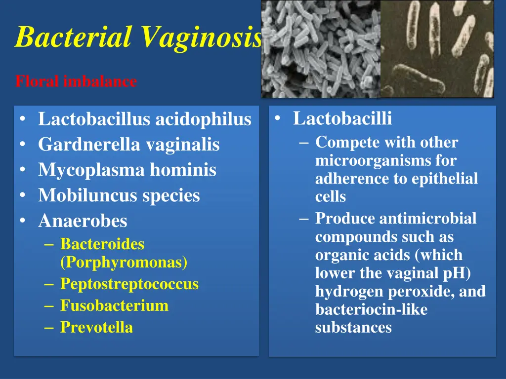bacterial vaginosis