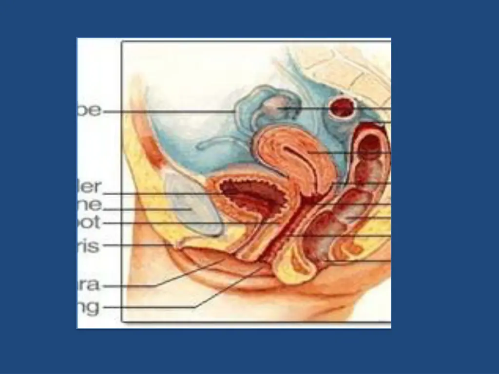 slide11