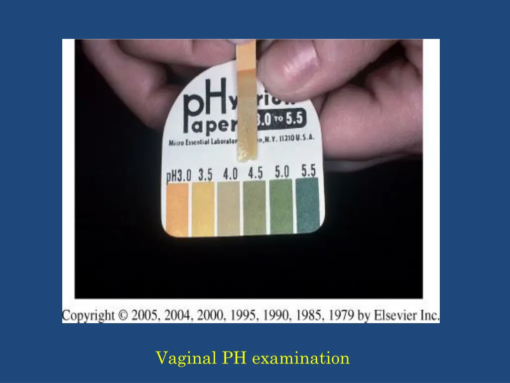 vaginal ph examination